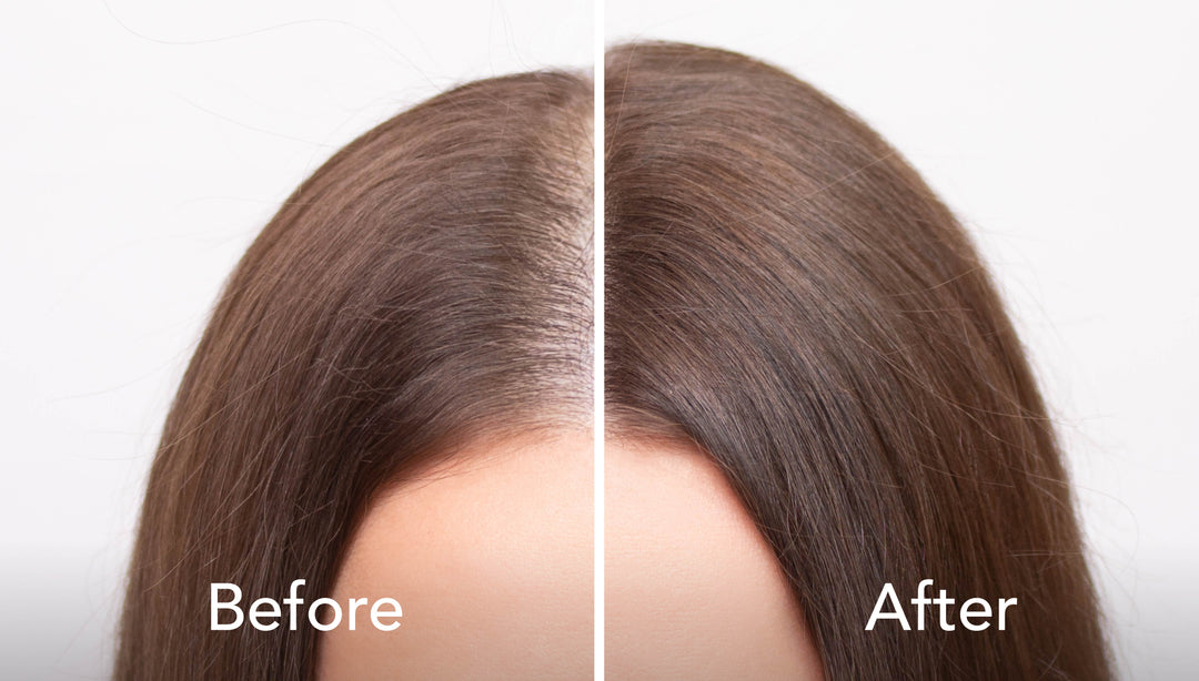 Have Thinning Hair or Hair Loss? Try a Topper. A HerWigCloset Guide to Alternative Hair Solutions